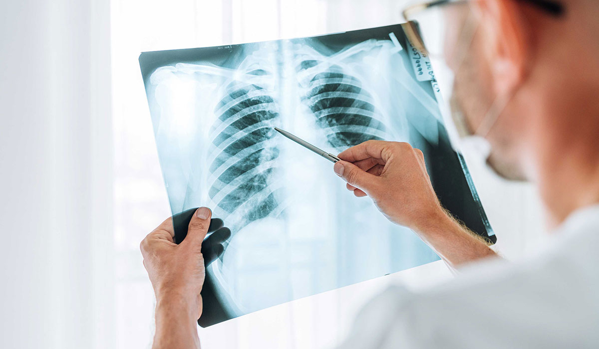 A doctor examining a chest x-ray