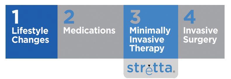 Infographic of a scale of changes that can help with gastroesophageal reflux from the least invasive to the most invasive and where stretta falls on that list